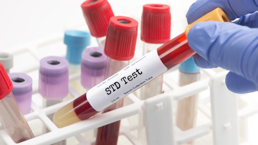 STD-Testing