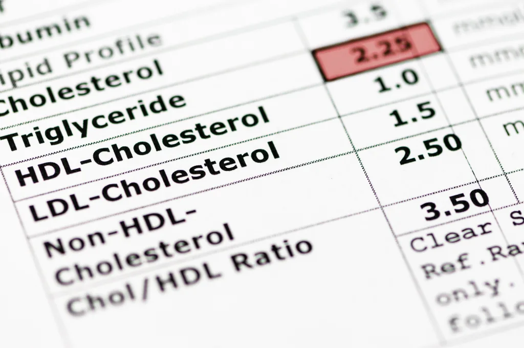 Cholesterol testing 